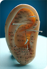 Auricular Acupuncture