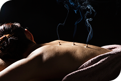 Moxibustion